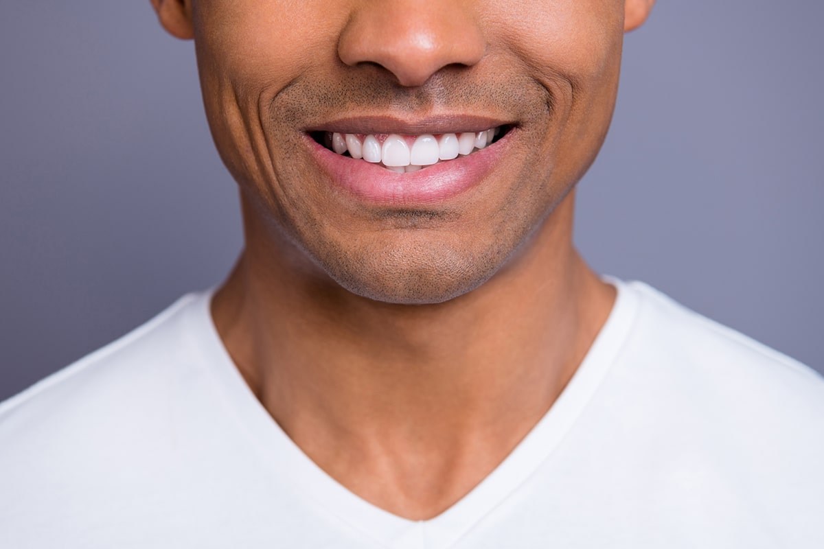 Teeth Whitening Options Which One Is Right For You Blog